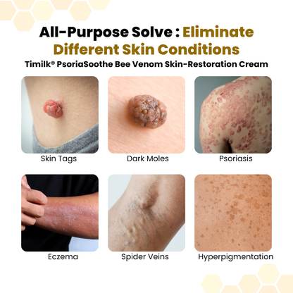 Last Day Of Discount 🔥 PsoriaSoothe Skin Care Cream.