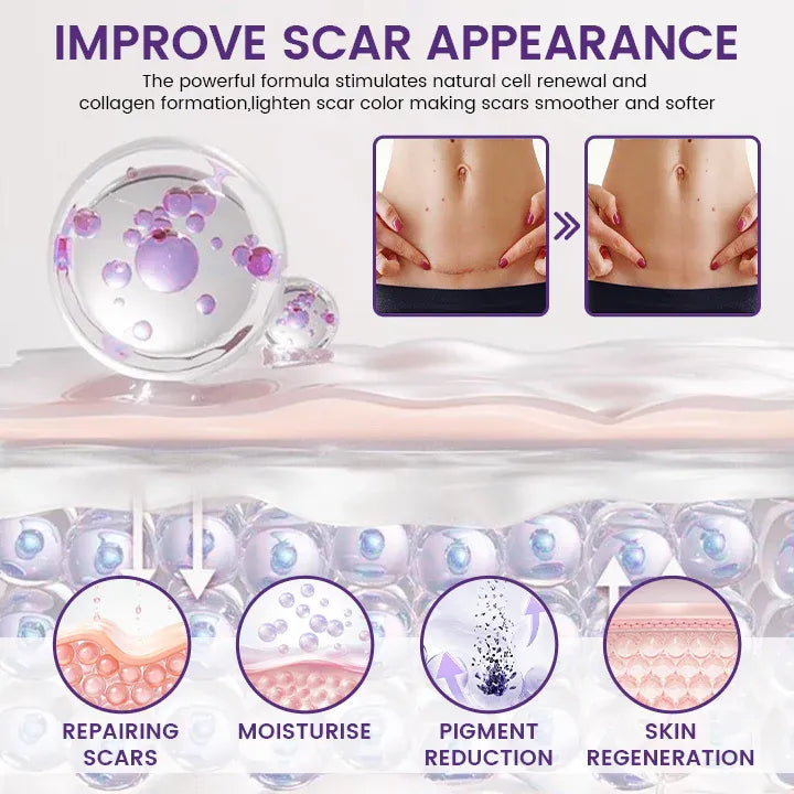 TiMilk - ReGen Scar Stem Cell Repair Gel