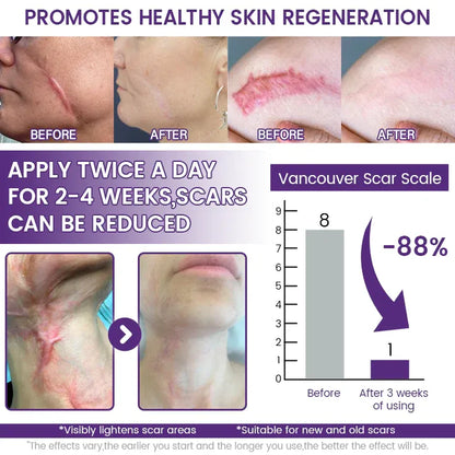 TiMilk - ReGen Scar Stem Cell Repair Gel